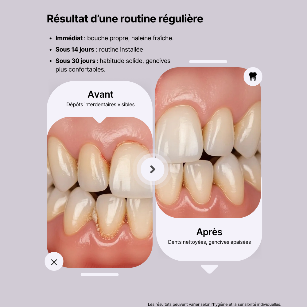 Smylis Original - Fil dentaire sonique